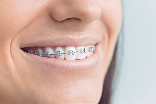 Best Crowns and Bridges  in Glen Ellyn, IL